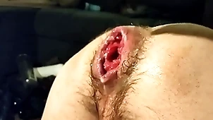 Toute seule fisting my loose hole added to prolapse:)