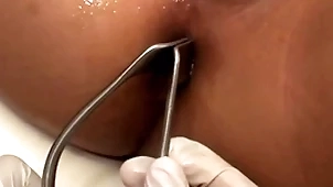 Asian invalid penetrated in anal hole apart from radiate in evangelist