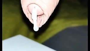Milking prostate
